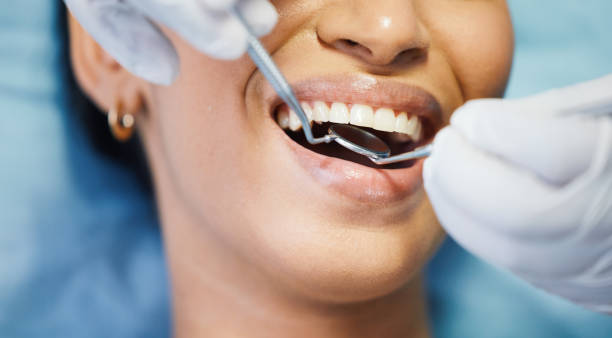 Best Emergency Denture Repair in Shorewood, WI